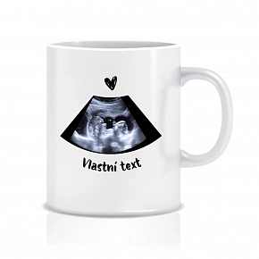 Personalizovaný klasický bílý keramický hrníček 300 ml s ultrazvukem